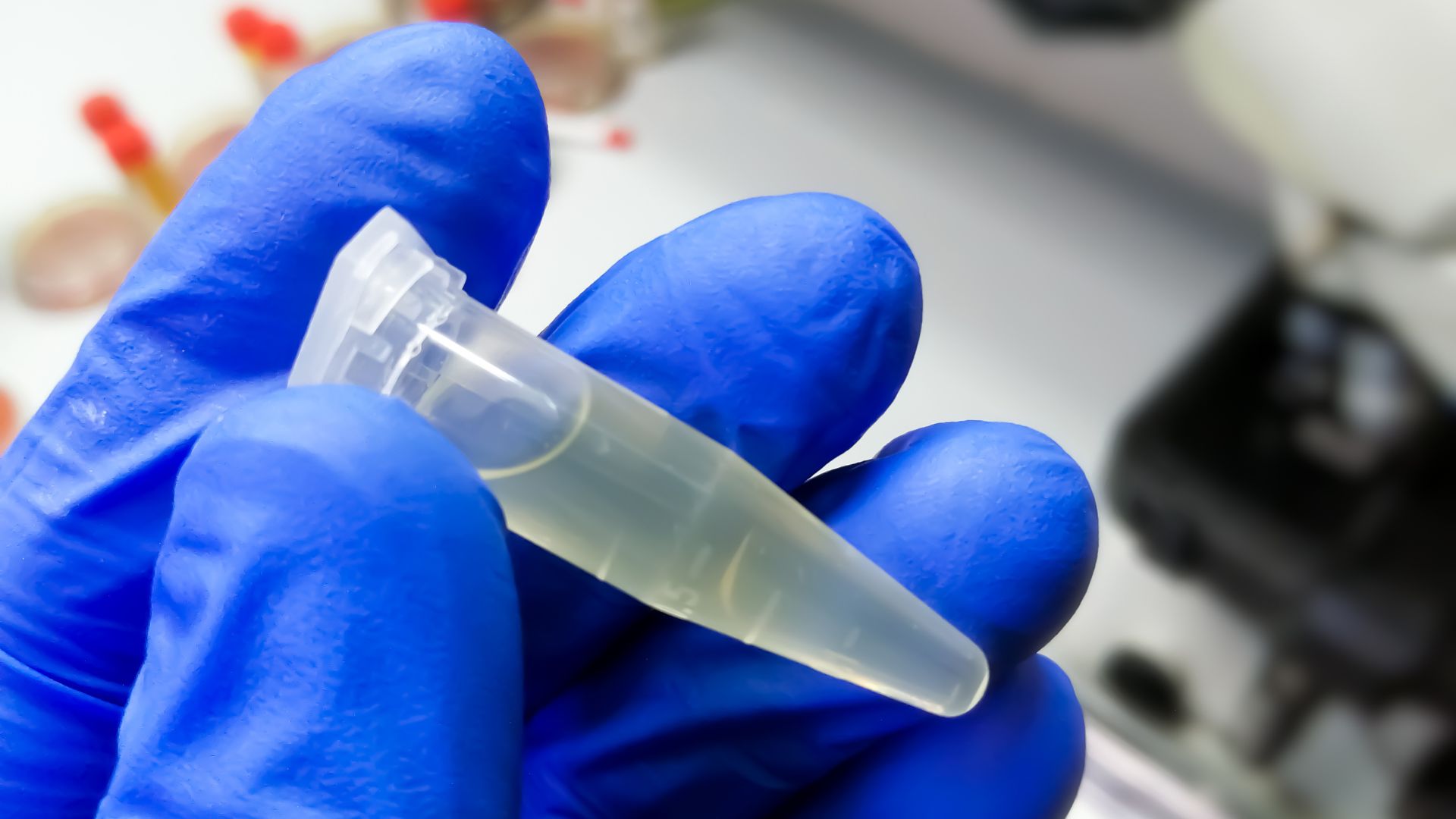 Tirando o DNA de dentro da célula